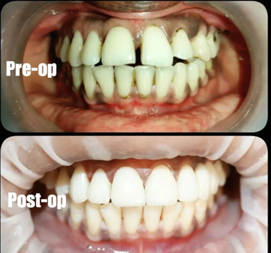 Slider image (7) Dr. A & T Dental Experts